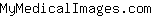 M***m